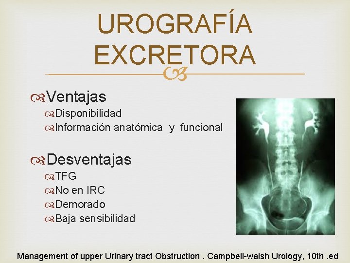 UROGRAFÍA EXCRETORA Ventajas Disponibilidad Información anatómica y funcional Desventajas TFG No en IRC Demorado