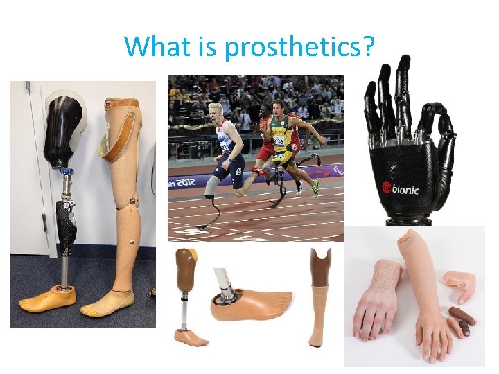 What is prosthetics? 