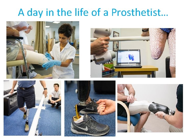 A day in the life of a Prosthetist… 