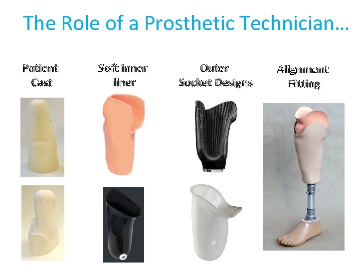 The Role of a Prosthetic Technician… Patient Cast Soft inner liner Outer Socket Designs