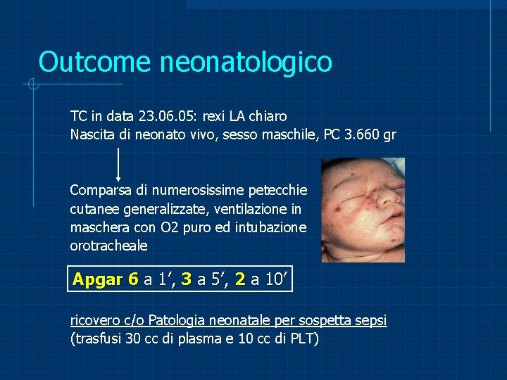 Outcome neonatologico TC in data 23. 06. 05: rexi LA chiaro Nascita di neonato