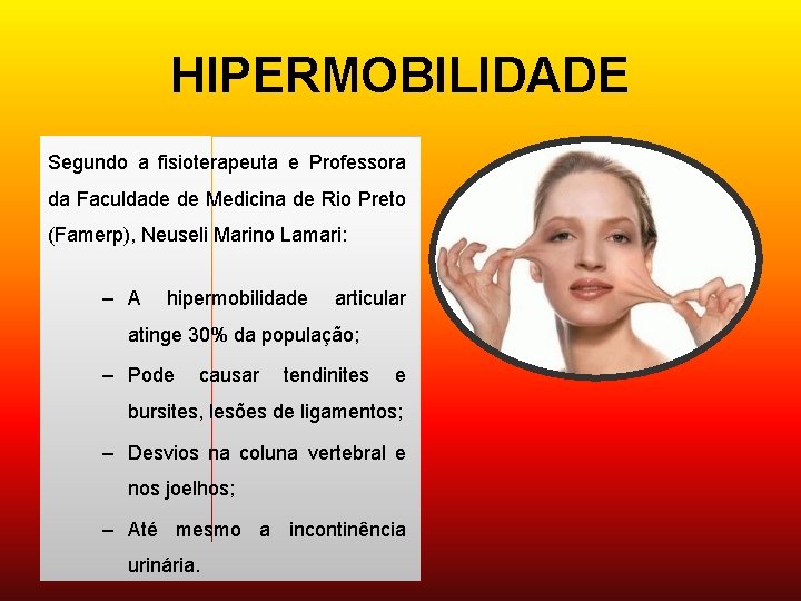 HIPERMOBILIDADE Segundo a fisioterapeuta e Professora da Faculdade de Medicina de Rio Preto (Famerp),