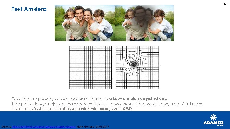 Test Amslera Wszystkie linie pozostają proste, kwadraty równe = siatkówka w plamce jest zdrowa