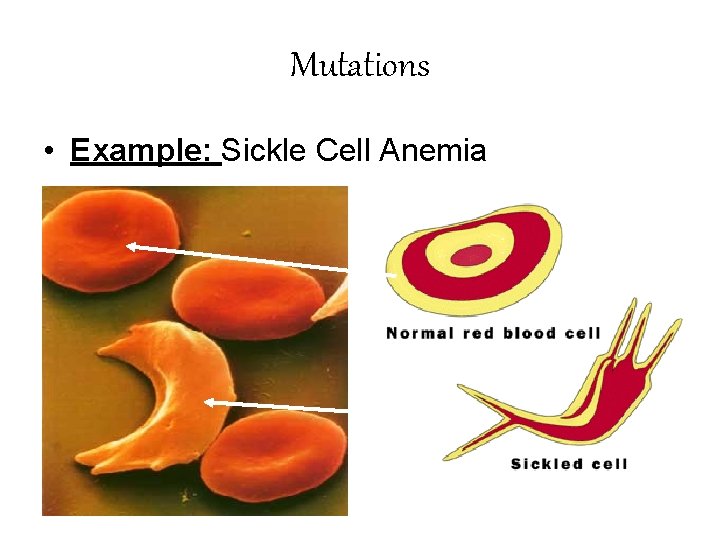 Mutations • Example: Sickle Cell Anemia 