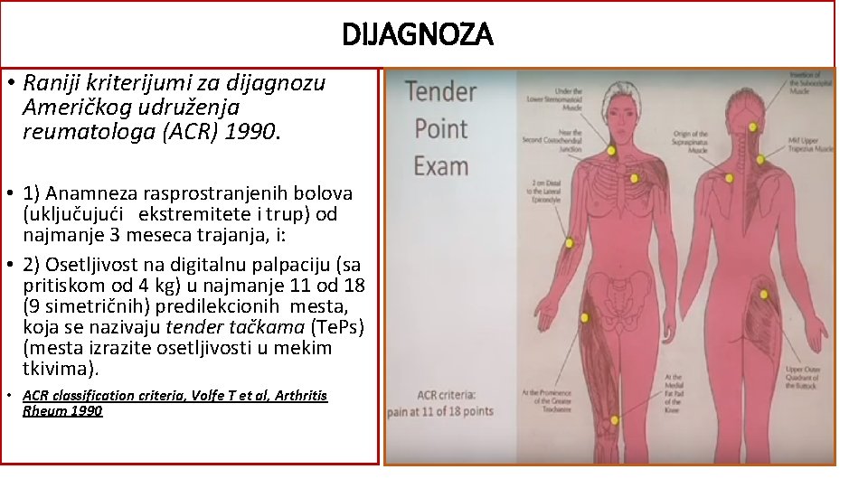 DIJAGNOZA • Raniji kriterijumi za dijagnozu Američkog udruženja reumatologa (ACR) 1990. • 1) Anamneza