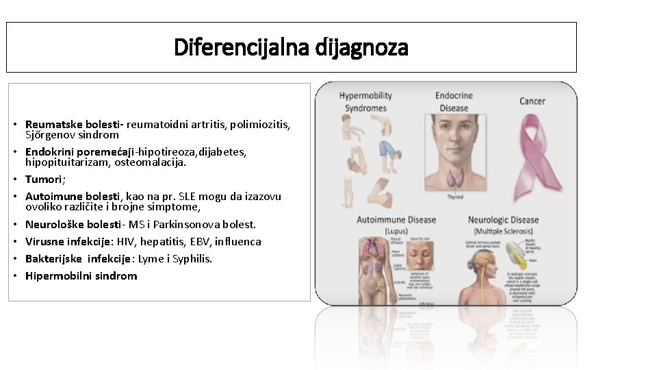 Diferencijalna dijagnoza • Reumatske bolesti- reumatoidni artritis, polimiozitis, Sjőrgenov sindrom • Endokrini poremećaji-hipotireoza, dijabetes,