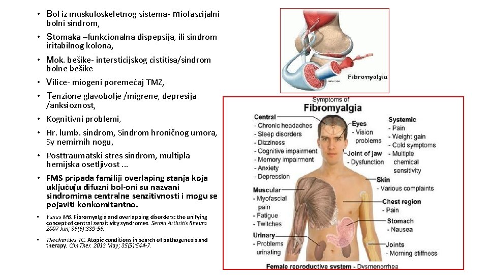  • Bol iz muskuloskeletnog sistema- miofascijalni bolni sindrom, • Stomaka –funkcionalna dispepsija, ili