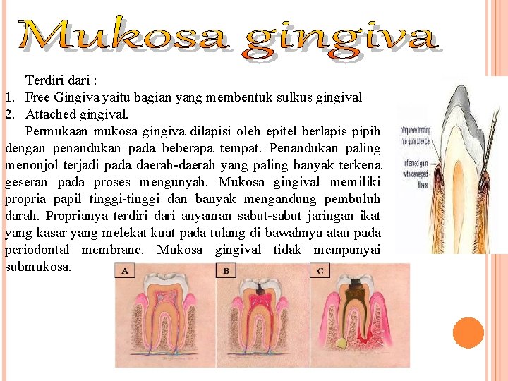 Terdiri dari : 1. Free Gingiva yaitu bagian yang membentuk sulkus gingival 2. Attached Terdiri dari : 1. Free Gingiva yaitu bagian yang membentuk sulkus gingival 2. Attached