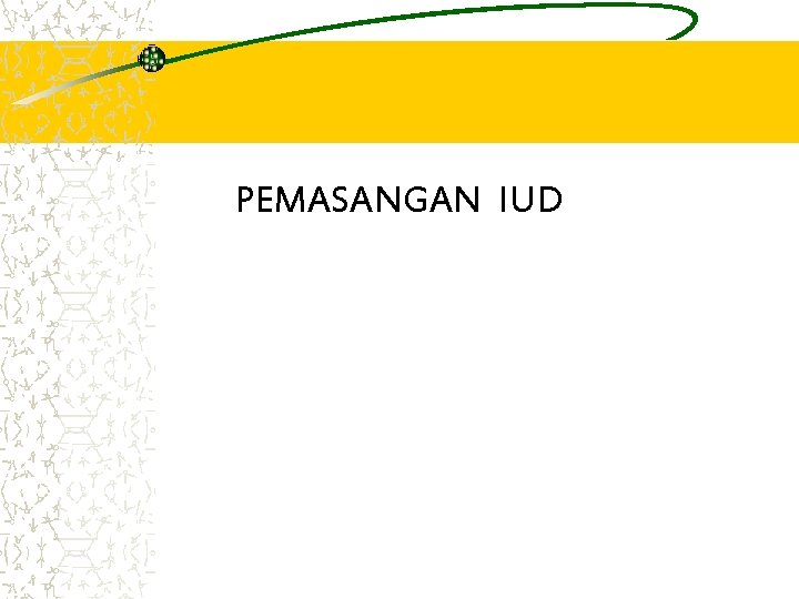 PEMASANGAN IUD 