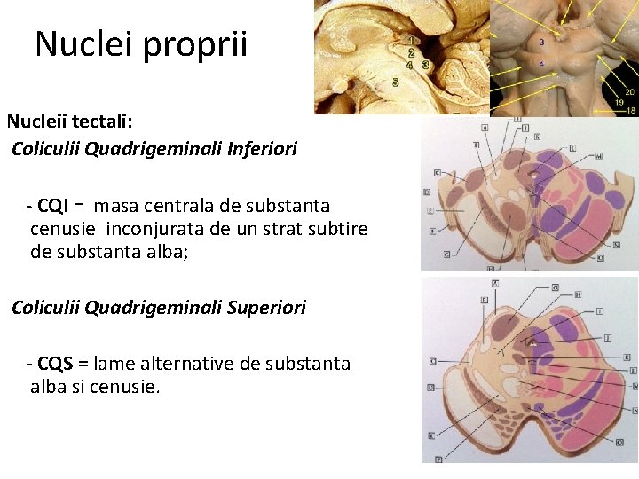 Nuclei proprii Nucleii tectali: Coliculii Quadrigeminali Inferiori - CQI = masa centrala de substanta