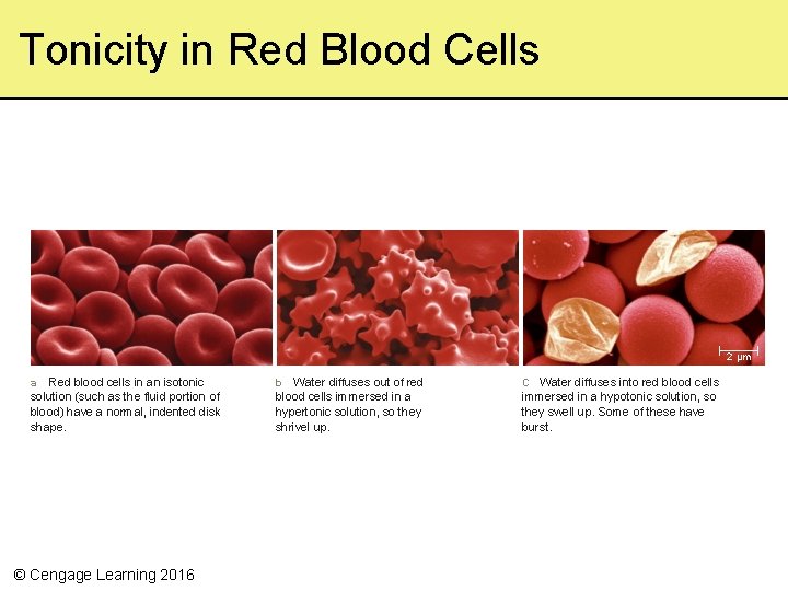 Tonicity in Red Blood Cells 2 µm a Red blood cells in an isotonic