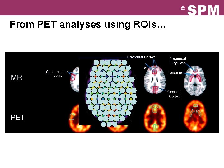 From PET analyses using ROIs… 