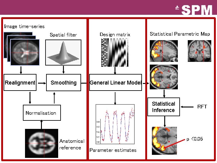 Image time-series Realignment Spatial filter Design matrix Smoothing General Linear Model Statistical Parametric Map