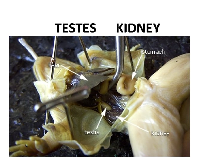 TESTES KIDNEY 