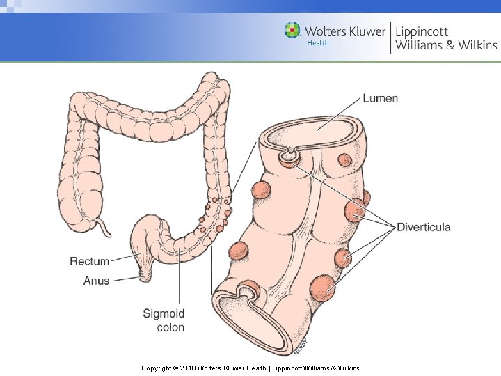 Copyright © 2010 Wolters Kluwer Health | Lippincott Williams & Wilkins 