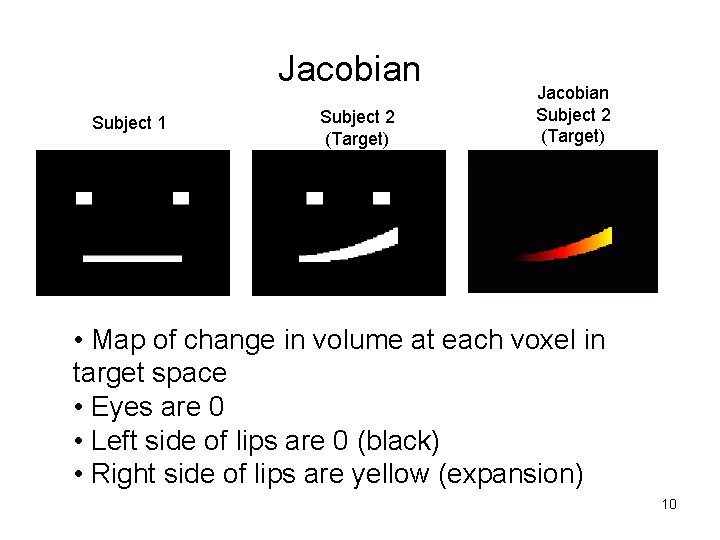 Jacobian Subject 1 Subject 2 (Target) Jacobian Subject 2 (Target) CSF • Map of