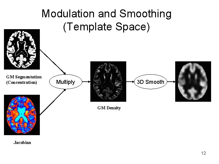 Modulation and Smoothing (Template Space) GM Segmentation (Concentration) Multiply 3 D Smooth GM Density