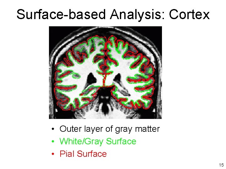 Surface-based Analysis: Cortex • Outer layer of gray matter • White/Gray Surface • Pial