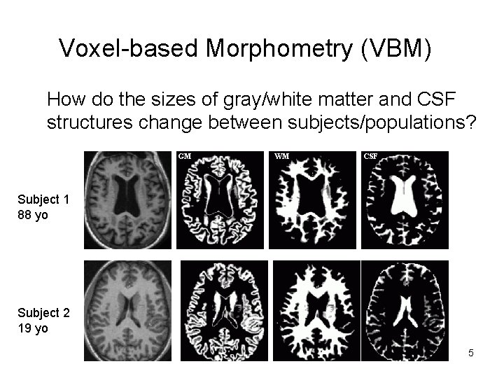 Voxel-based Morphometry (VBM) How do the sizes of gray/white matter and CSF structures change