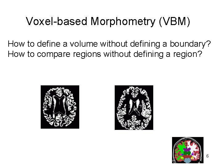 Voxel-based Morphometry (VBM) How to define a volume without defining a boundary? How to
