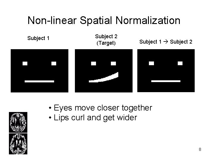 Non-linear Spatial Normalization Subject 1 Subject 2 (Target) Subject 1 Subject 2 CSF •