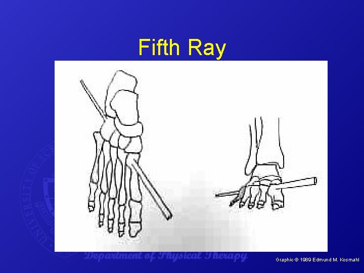 Fifth Ray Graphic © 1989 Edmund M. Kosmahl. 