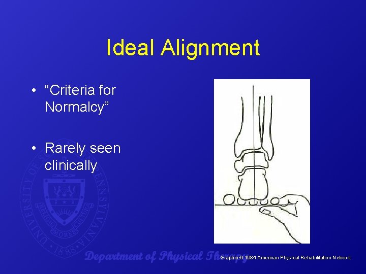 Ideal Alignment • “Criteria for Normalcy” • Rarely seen clinically Graphic © 1984 American