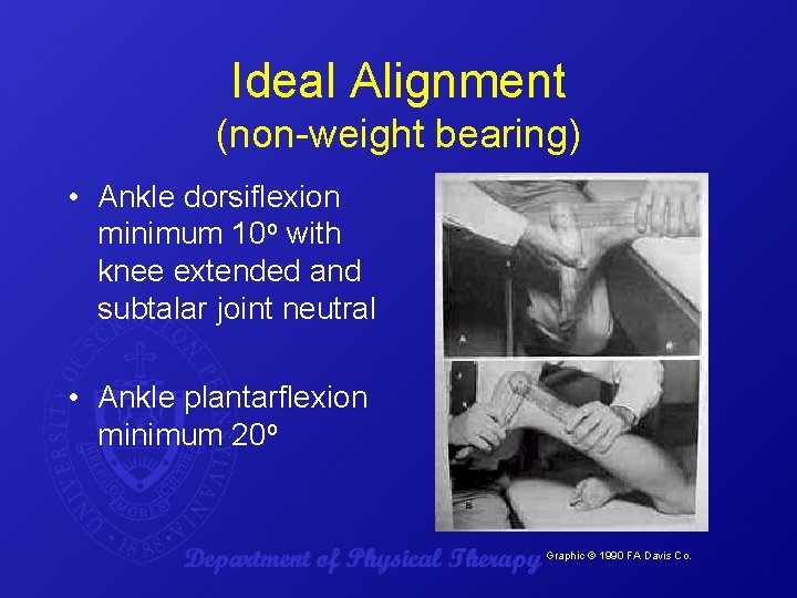 Ideal Alignment (non-weight bearing) • Ankle dorsiflexion minimum 10 o with knee extended and