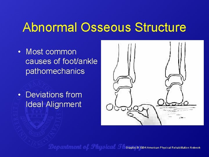 Abnormal Osseous Structure • Most common causes of foot/ankle pathomechanics • Deviations from Ideal