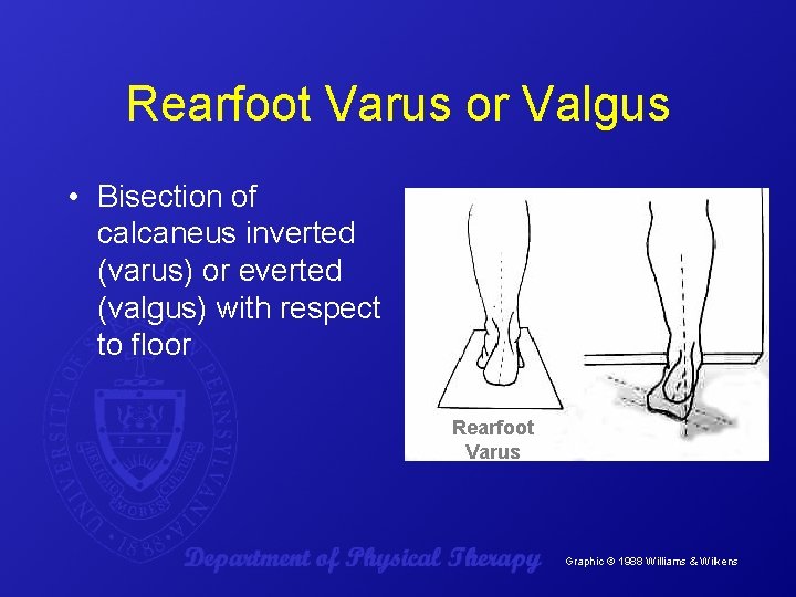 Rearfoot Varus or Valgus • Bisection of calcaneus inverted (varus) or everted (valgus) with