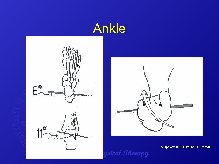 Ankle Graphic © 1989 Edmund M. Kosmahl. 