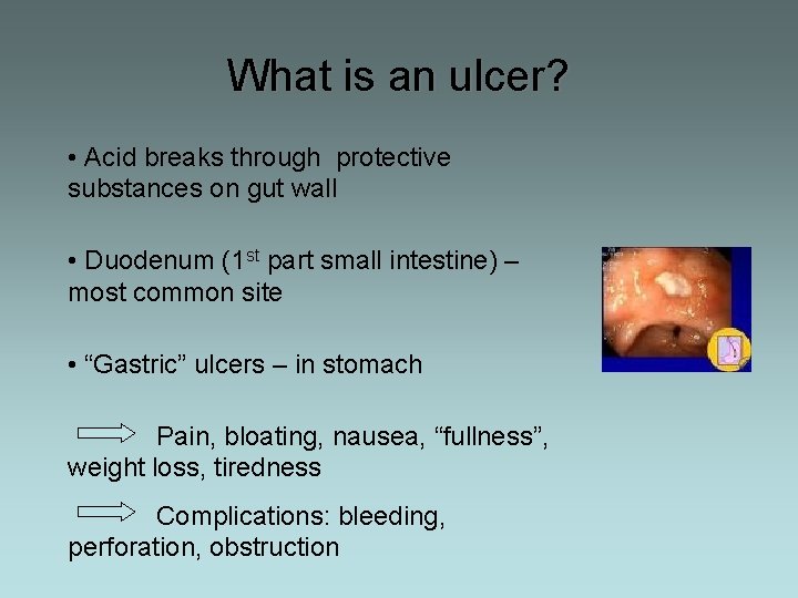 What is an ulcer? • Acid breaks through protective substances on gut wall •