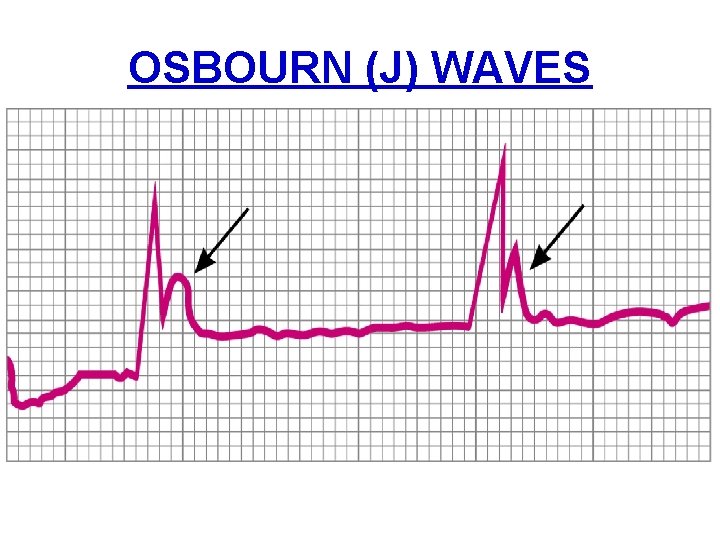 OSBOURN (J) WAVES 