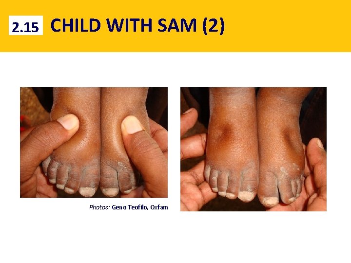 2. 15 CHILD WITH SAM (2) Photos: Geno Teofilo, Oxfam 