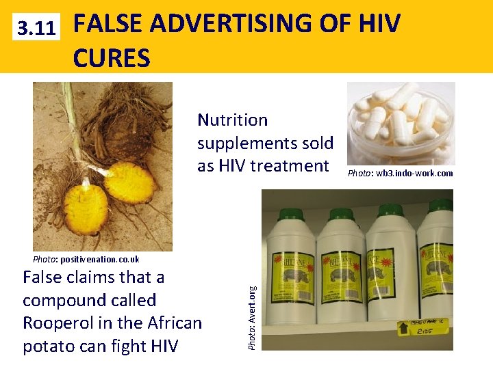 3. 11 FALSE ADVERTISING OF HIV CURES Nutrition supplements sold as HIV treatment False