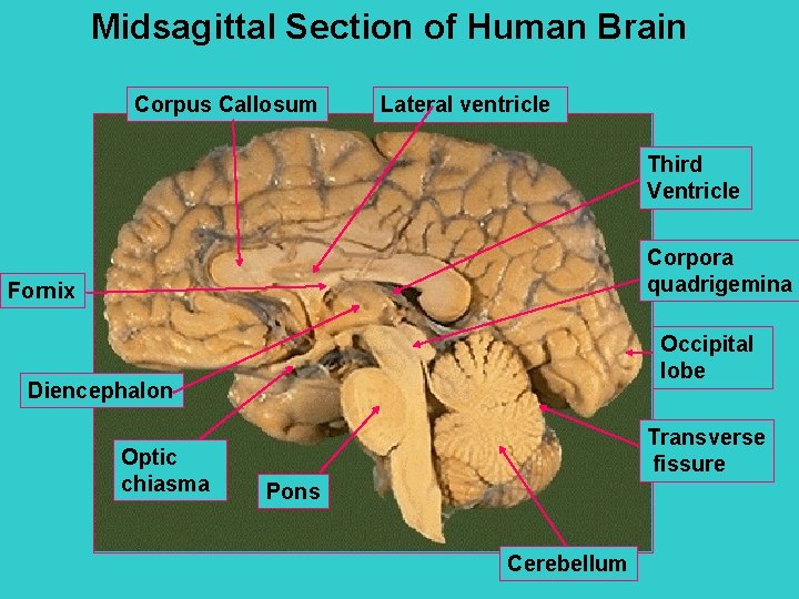 Midsagittal Section of Human Brain Corpus Callosum Lateral ventricle Third Ventricle Corpora quadrigemina Fornix
