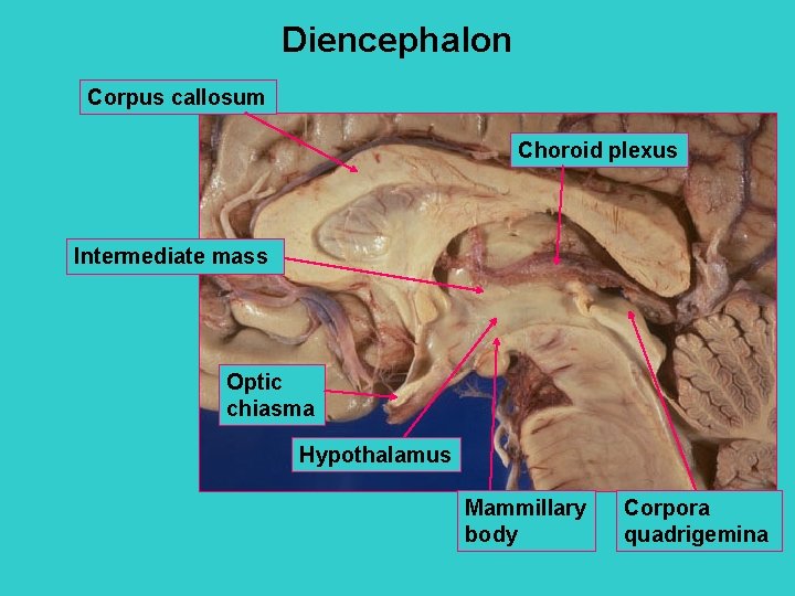 Diencephalon Corpus callosum Choroid plexus Intermediate mass Optic chiasma Hypothalamus Mammillary body Corpora quadrigemina