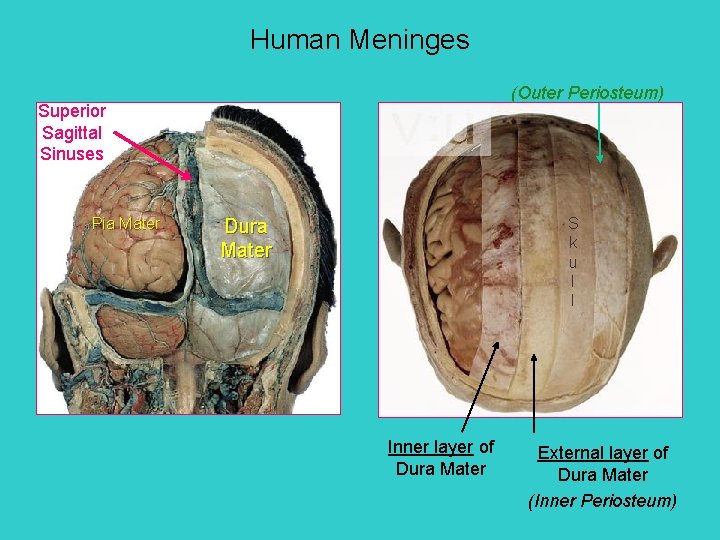 Human Meninges (Outer Periosteum) Superior Sagittal Sinuses Pia Mater S k u l l