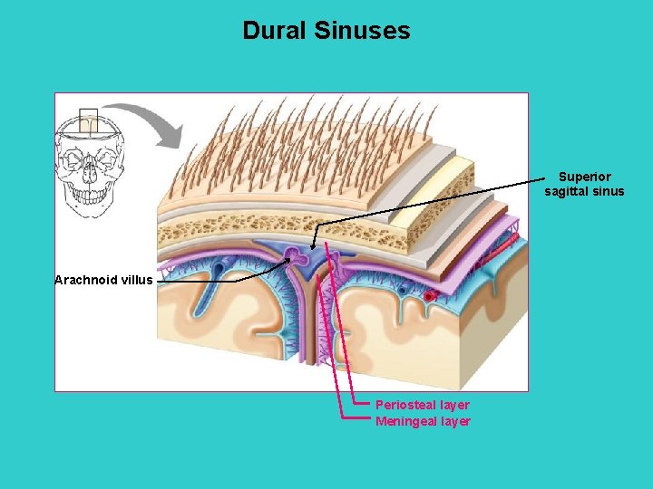 Dural Sinuses Superior sagittal sinus Arachnoid villus Periosteal layer Meningeal layer 