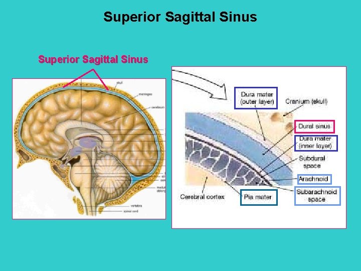 Superior Sagittal Sinus 