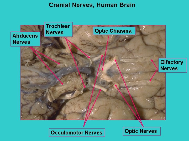 Cranial Nerves, Human Brain Abducens Nerves Trochlear Nerves Optic Chiasma Olfactory Nerves Occulomotor Nerves