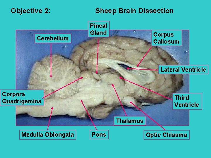 Objective 2: Cerebellum Sheep Brain Dissection Pineal Gland Corpus Callosum Lateral Ventricle Corpora Quadrigemina