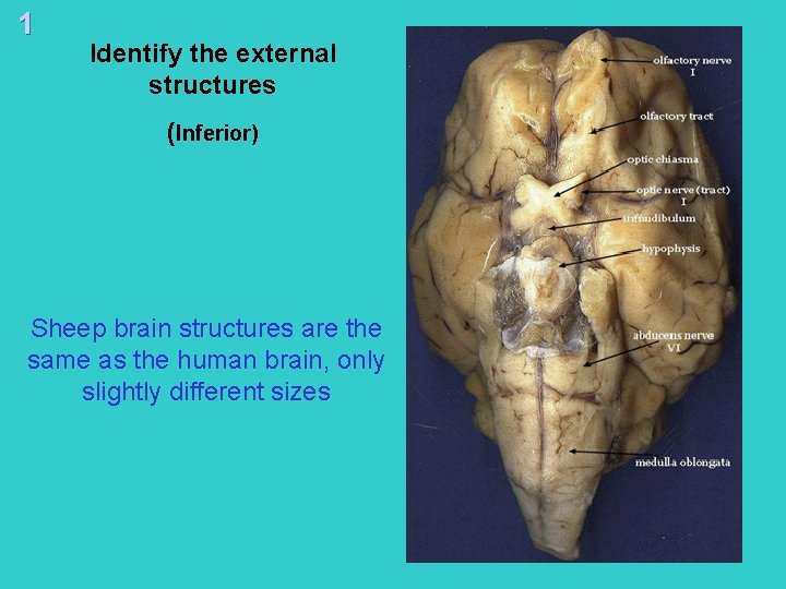 1 Identify the external structures (Inferior) Sheep brain structures are the same as the