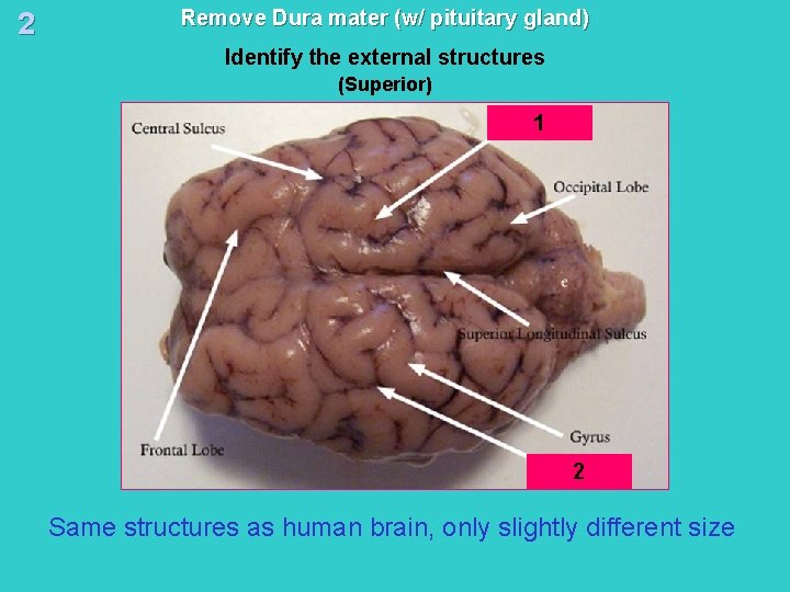 2 Remove Dura mater (w/ pituitary gland) Identify the external structures (Superior) 1 2