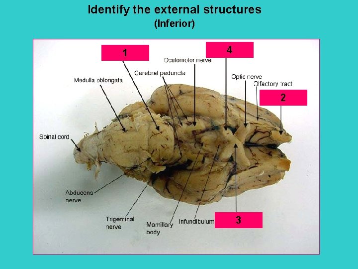 Identify the external structures (Inferior) 1 4 2 3 