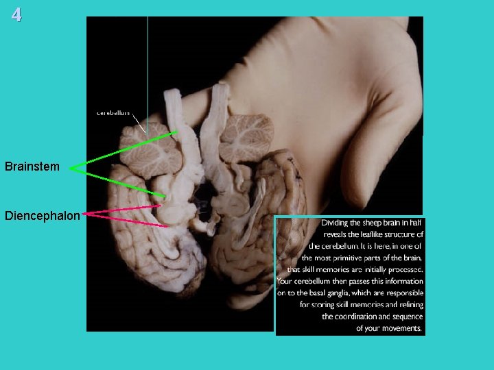 4 Brainstem Diencephalon 