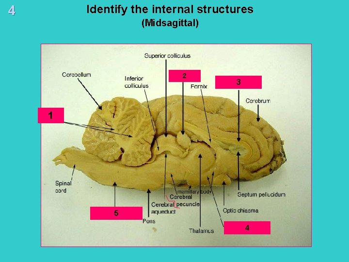 Identify the internal structures 4 (Midsagittal) 2 3 1 5 4 