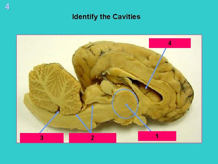 4 Identify the Cavities Lateral 4 Ventricle Fourth Ventricle 3 Cerebral 2 Aqueduct 1