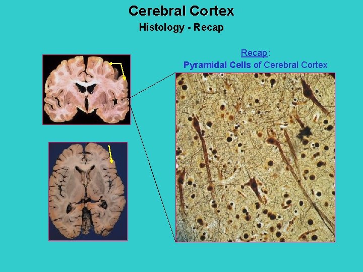 Cerebral Cortex Histology - Recap: Pyramidal Cells of Cerebral Cortex 