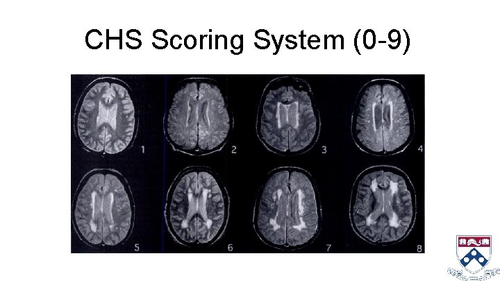 CHS Scoring System (0 -9) 
